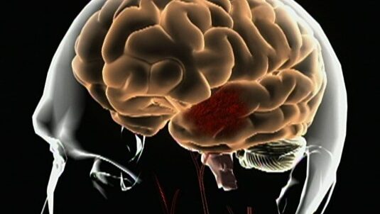 brain.jpg